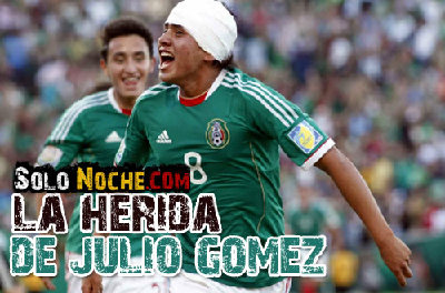 herida-julio.jpg